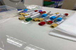 宫腔镜所滋生的并发症有哪些