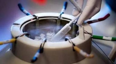 石家庄做二代试管费用