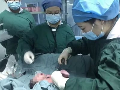 一代试管婴儿比二代试管婴儿好吗,妊娠率有差异吗