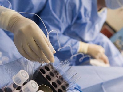 做第二代试管婴儿时精子是怎样挑选的