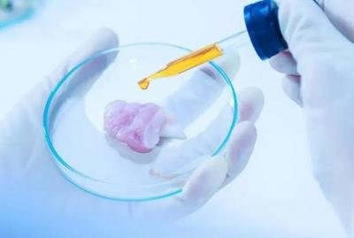 究竟什么是宫腔镜呢？难孕的人一定要做宫腔镜吗