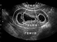 排卵障碍有机会怀孕吗能否试管婴儿助孕