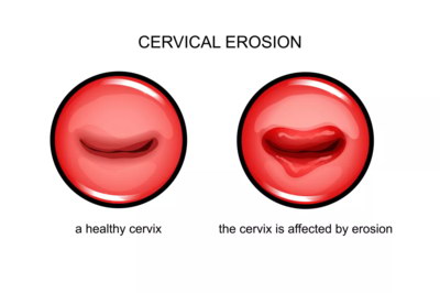 试管婴儿助孕医治对子宫环境有要求吗
