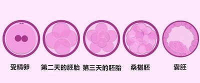 抗精子抗体指标异常会影响女性的试管医治吗