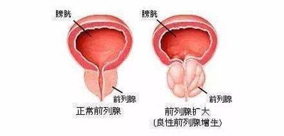 试管婴儿医治过程中使用的药物真的会致癌吗