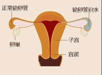 试管初次失败了还能再次移植吗