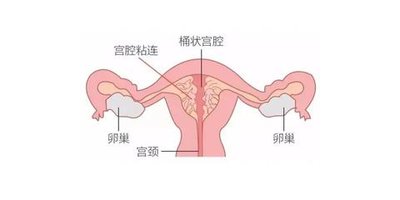 甲状腺激素偏高会不会影响试管胚胎正常着床