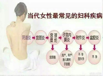 诊断是否胎停的规范是什么？为什么会出现胎停的情况