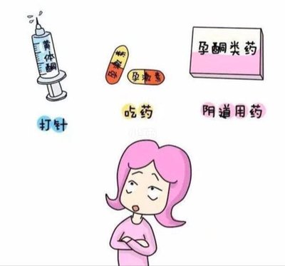 试管婴儿助孕过程取卵术前的注意事项有哪些