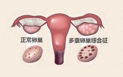 试管婴儿移植术后会有什么不适感觉吗