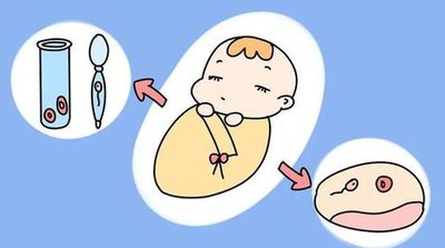 月经频繁、黄体功能不全会导致女性不孕吗