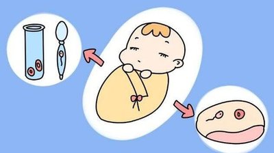 巧克力囊肿月经失调能不能试管婴儿助孕