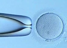 女性不孕宫颈息肉能不能试管婴儿助孕医治