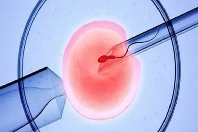 深圳试管医治中为什么长期需要进行黄体支持