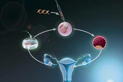 为什么会患上子宫腺肌症还能做深圳试管婴儿助孕吗