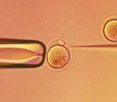 生活中有哪些预防妇科炎症的办法