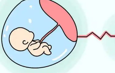 患上盆腔粘连危害是什么还能试管婴儿助孕吗