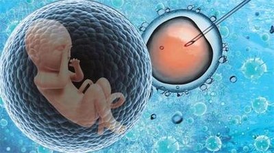 免疫性不孕症患者想怀孕可以进行试管婴儿吗
