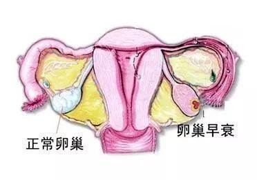 做试管婴儿，男性饮食要这样吃