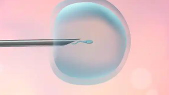 要进行试管移植了,作为老公的需要做点什么