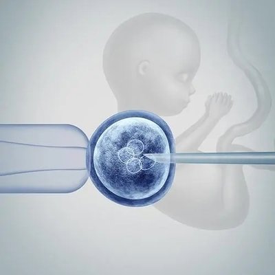女性的子宫内膜上有息肉通常需要怎么处置