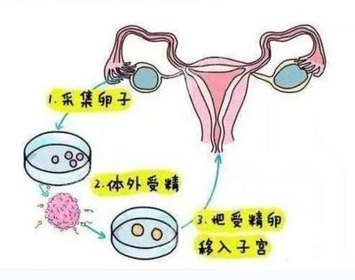 在试管中造成胎停育的原因大致有哪几种
