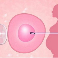 试管婴儿进周前后的注意事项有哪些