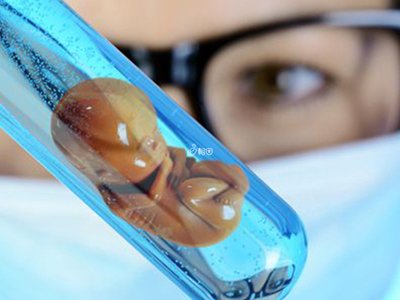 中山试管婴儿进周医治前女性是否需要做宫颈癌筛查