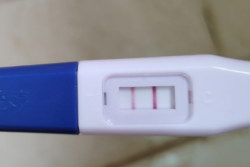 巧克力囊肿月经失调能不能试管婴儿助孕