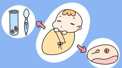 子宫肌瘤患者不孕好几年了能去考虑潮州试管婴儿助孕吗