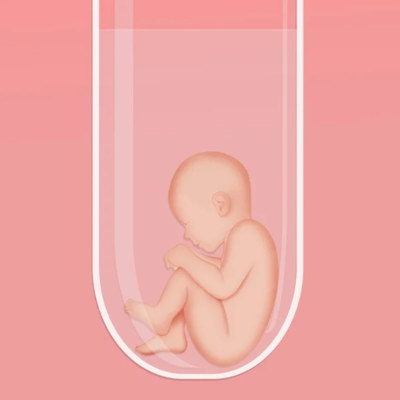 试管婴儿助孕想快点胜利该如何做
