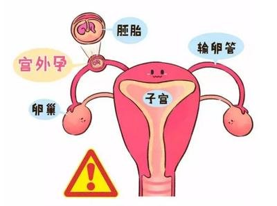 FSH高的患者做试管婴儿还有希望正常生养吗