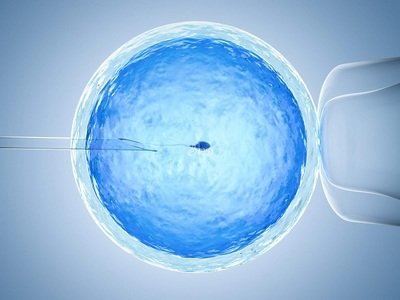 男性精子数量少或少精子症适合试管婴儿吗