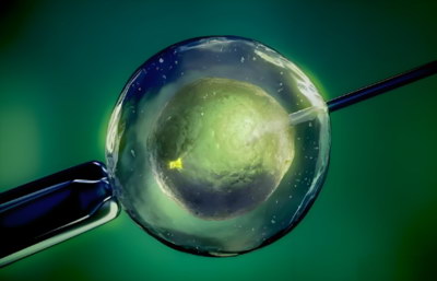 试管婴儿医治什么时候体检好，需要做哪些体检项目