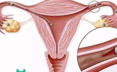 女性难孕卵子质量不好适合试管婴儿辅助生养吗