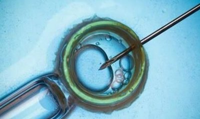 子宫畸形或双角子宫还可以生育吗影响揭阳试管婴儿医治吗