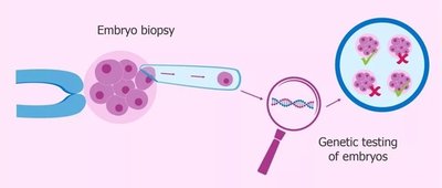 女性难孕卵子质量不好适合潮州试管婴儿辅助生育吗
